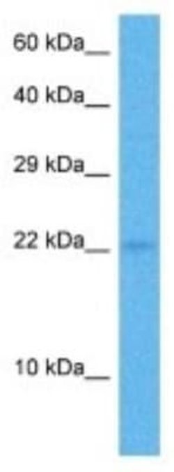 COPZ1 Rabbit anti-Human, Polyclonal, Novus Biologicals:Antibodies:Primary